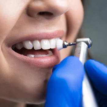 Dentist using special tool to clean teen's teeth