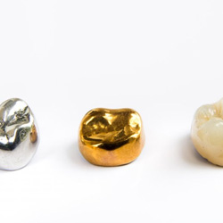 Three different types of crowns lined up in a row