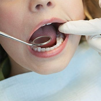 Closeup of child during dental treatment