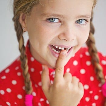 Child pointing to missing front tooth