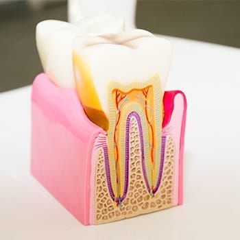 Model of the inside of a tooth